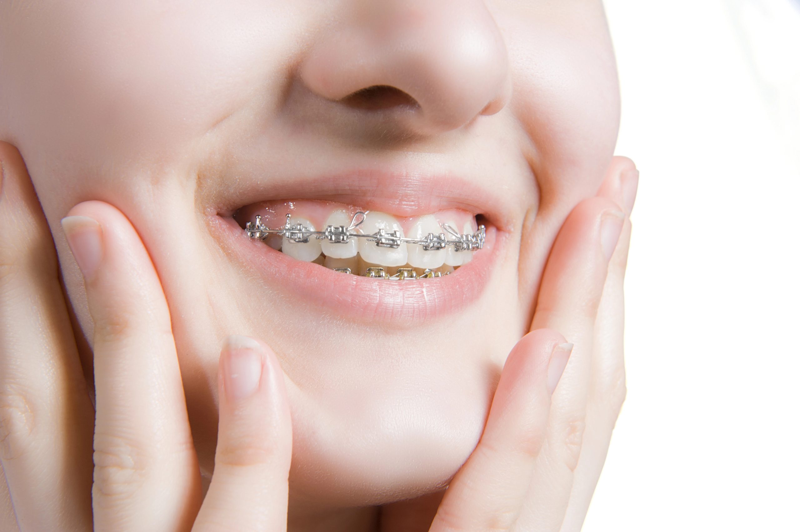Mukwonago Braces: What To Know Before Getting Started